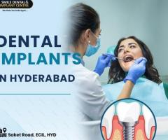 Dental Implant cost in Hyderabad | Dr Puli Sudhakar MDS